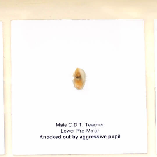 Display cabinet with Teachers teeth